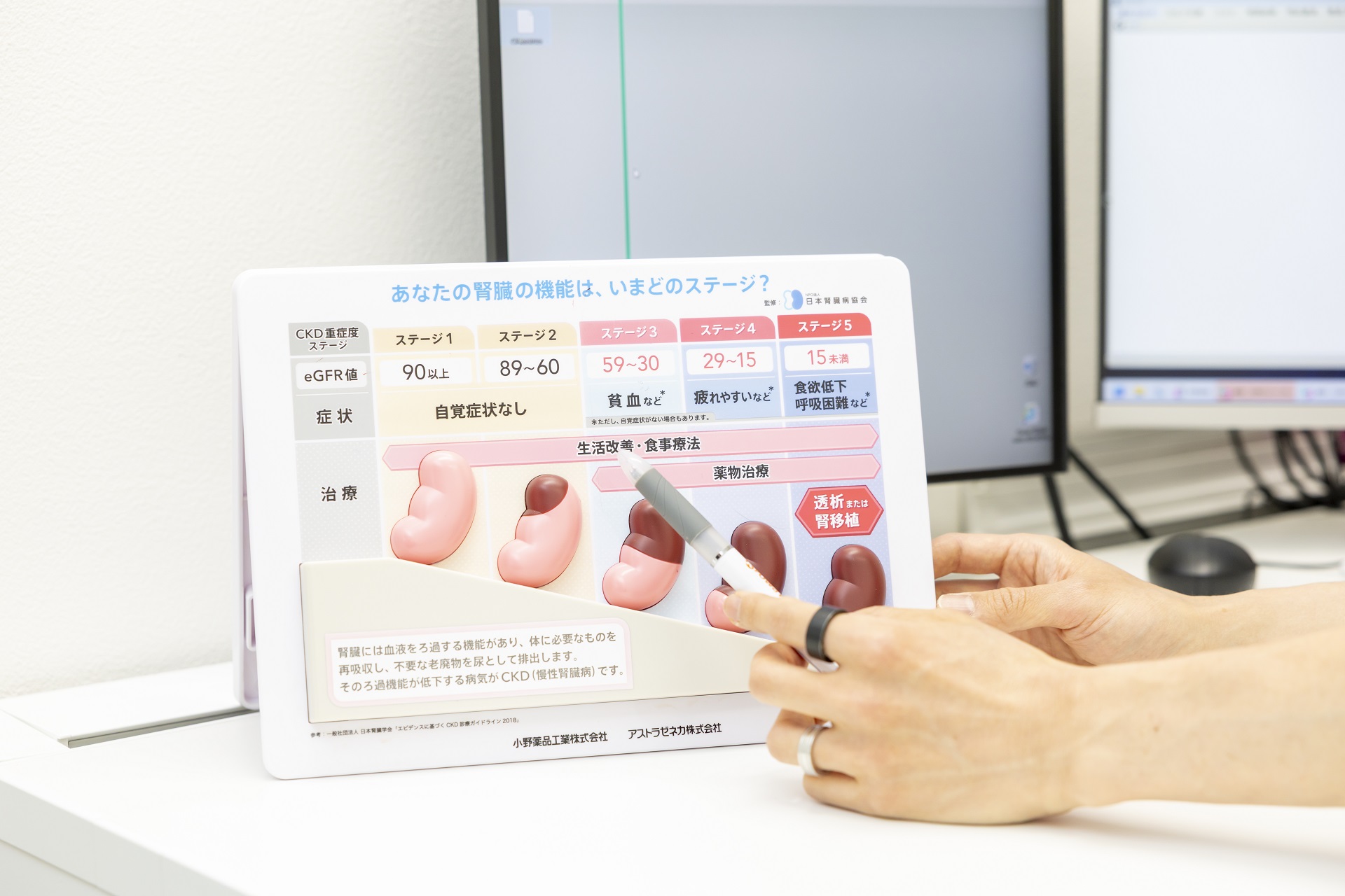 生活習慣病と慢性腎臓病の関係